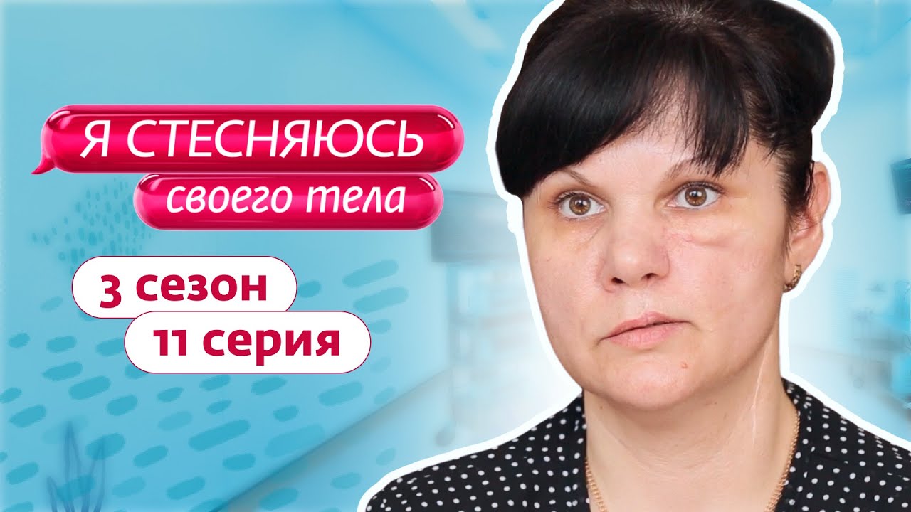 Стесняюсь Обнаженного Тела